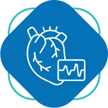 Ecocardiograma