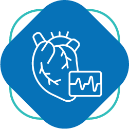 Ecocardiograma Ecocardiograma